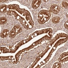 Anti-ZNF776 Antibody