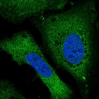 Immunofluorescent staining of human cell line U-2 OS shows localization to cytosol.