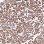 Immunohistochemical staining of human heart muscle shows moderate cytoplasmic positivity in cardiomyocytes.