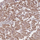 Immunohistochemical staining of human heart muscle shows moderate cytoplasmic positivity in cardiomyocytes.