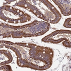 Immunohistochemical staining of human duodenum shows moderate cytoplasmic and membranous positivity in glandular cells.