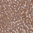 Immunohistochemical staining of human liver shows strong granular cytoplasmic positivity in hepatocytes.
