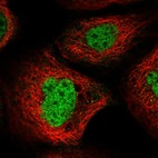 Immunofluorescent staining of human cell line A-431 shows localization to nucleoplasm.