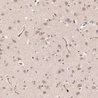 Anti-SHC3 Antibody