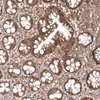 Immunohistochemical staining of human rectum shows moderate membranous and cytoplasmic positivity in glandular cells.