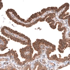 Immunohistochemical staining of human fallopian tube shows moderate membranous and cytoplasmic positivity in glandular cells.