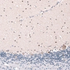 Immunohistochemical staining of human cerebellum shows moderate cytoplasmic positivity in cells in molecular layer.