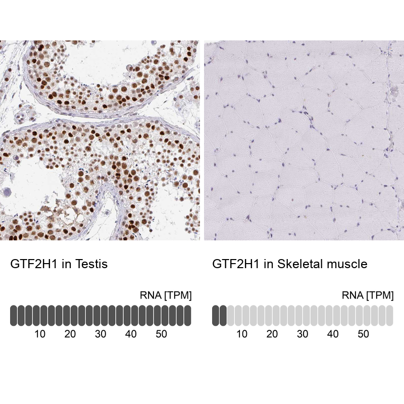 Anti-GTF2H1 Antibody