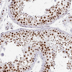 Immunohistochemical staining of human testis shows strong nuclear positivity in cells in seminiferous ducts.