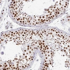 Immunohistochemical staining of human testis shows strong nuclear positivity in cells in seminiferous ducts.