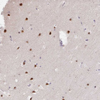Immunohistochemical staining of human cerebral cortex shows strong nuclear positivity in neurons.