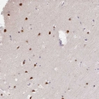 Immunohistochemical staining of human cerebral cortex shows strong nuclear positivity in neurons.