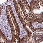 Anti-ZNF667 Antibody