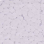 Immunohistochemical staining of human skeletal muscle shows no nuclear positivity in myocytes.