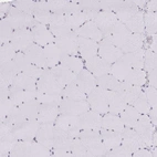 Immunohistochemical staining of human skeletal muscle shows no nuclear positivity in myocytes.