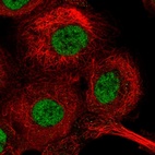 Immunofluorescent staining of human cell line A-431 shows localization to nucleoplasm.