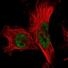 Immunofluorescent staining of human cell line U-251 MG shows localization to nucleoplasm.
