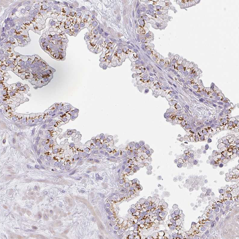 Anti-ATP8B2 Antibody