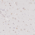 Immunohistochemical staining of human Cerebral cortex shows weak granular cytoplasmic positivity in neuronal cells.