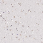Immunohistochemical staining of human Cerebral cortex shows weak granular cytoplasmic positivity in neuronal cells.