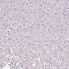 Anti-ATP8B2 Antibody