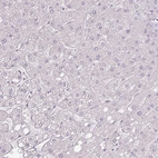 Immunohistochemical staining of human Liver shows very weak granular cytoplasmic positivity in hepatocytes.