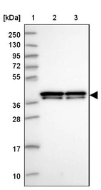 Lane 1: Marker [kDa] 250, 130, 95, 72, 55, 36, 28, 17, 10_br/_Lane 2: Human cell line RT-4_br/_Lane 3: Human cell line U-251MG sp
