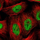 Immunofluorescent staining of human cell line U-2 OS shows localization to nucleoplasm.