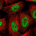 Immunofluorescent staining of human cell line U-2 OS shows localization to nucleoplasm.