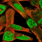 Immunofluorescent staining of human cell line RH-30 shows localization to nucleoplasm, cytosol & centrosome.