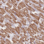 Anti-UQCRQ Antibody