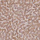 Immunohistochemical staining of human liver shows strong granular cytoplasmic positivity in hepatocytes.