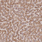 Anti-UQCRQ Antibody