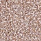 Immunohistochemical staining of human liver shows strong granular cytoplasmic positivity in hepatocytes.