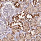 Immunohistochemical staining of human kidney shows moderate to strong granular cytoplasmic positivity in cells in tubules.