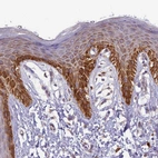 Immunohistochemical staining of human skin shows moderate to strong granular cytoplasmic positivity in squamous epithelial cells.