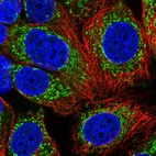 Immunofluorescent staining of human cell line MCF7 shows localization to mitochondria.
