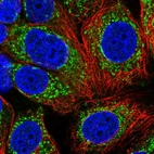 Immunofluorescent staining of human cell line MCF7 shows localization to mitochondria.