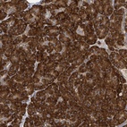 Anti-NOMO1 Antibody