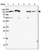 Lane 1: Marker [kDa] 250, 130, 95, 72, 55, 36, 28, 17, 10_br/_Lane 2: Human cell line RT-4_br/_Lane 3: Human cell line U-251 MG_br/_Lane 4: Human plasma_br/_Lane 5: Human Liver tissue_br/_Lane 6: Human Tonsil tissue