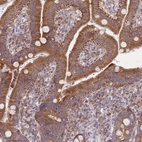 Immunohistochemical staining of human duodenum shows strong granular cytoplasmic positivity in glandular cells.