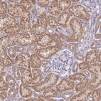 Immunohistochemical staining of human kidney shows strong granular cytoplasmic positivity in cells in tubules.