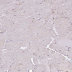Immunohistochemical staining of human skeletal muscle shows no positivity in myocytes as expected.