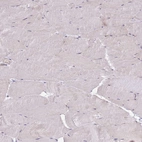 Immunohistochemical staining of human skeletal muscle shows no positivity in myocytes as expected.