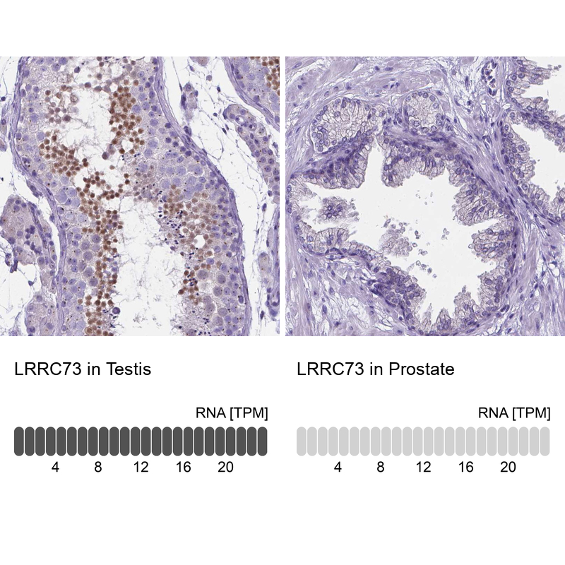 Anti-LRRC73 Antibody