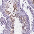 Immunohistochemical staining of human testis shows high expression.