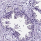 Immunohistochemical staining of human prostate shows low expression as expected.