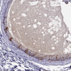 Immunohistochemical staining of human epididymis shows high expression.