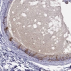 Immunohistochemical staining of human epididymis shows high expression.