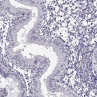 Immunohistochemical staining of human endometrium shows low expression as expected.